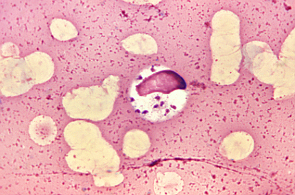 leishmaniose-protozoario-430x285