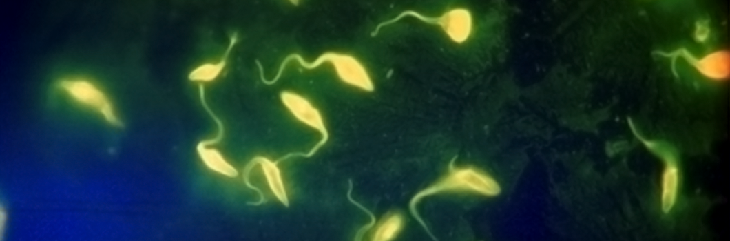 trypanossoma cruzi imunofluorescencia