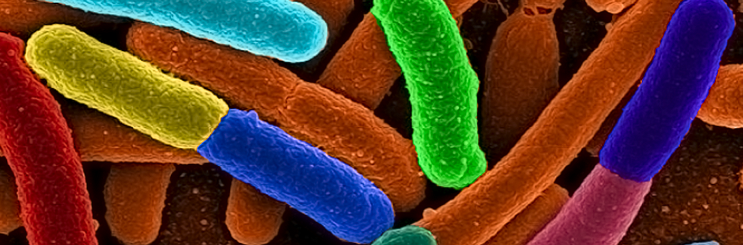 e coli