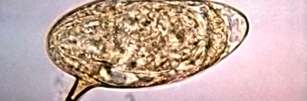 ovo schistosoma mansoni