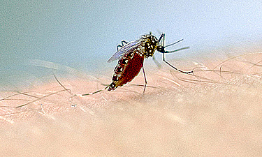 microcefalia zika