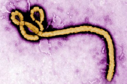 ebola-virus