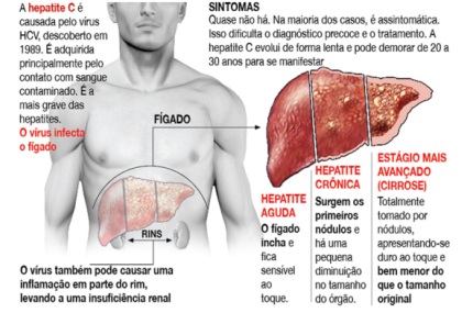 hepatite-interna